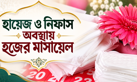 হজ্ব করাকালীন হায়েজ এসে গেলে করণীয় কী?